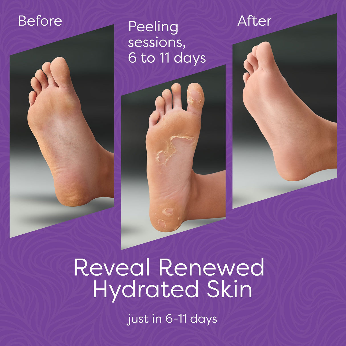 Aesta 3-in-1 Foot Peel Mask Set – Exfoliating Foot Mask with Moisturizer & Cleanser for Dry, Cracked Heels & Callus Removal – Plant-Based, Vegan, Men & Women