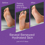 Aesta 3-in-1 Foot Peel Mask Set – Exfoliating Foot Mask with Moisturizer & Cleanser for Dry, Cracked Heels & Callus Removal – Plant-Based, Vegan, Men & Women