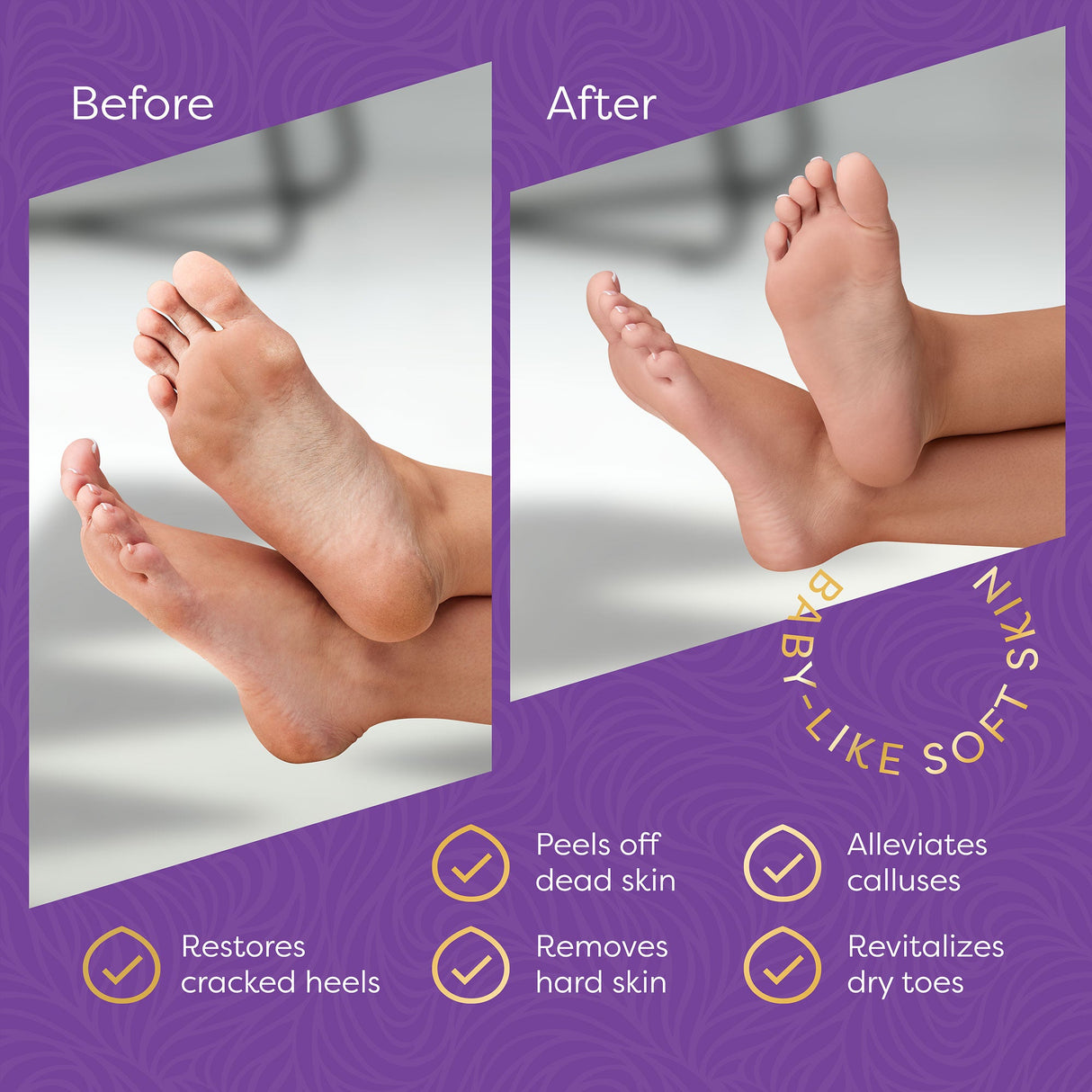 Aesta 3-in-1 Foot Peel Mask Set – Exfoliating Foot Mask with Moisturizer & Cleanser for Dry, Cracked Heels & Callus Removal – Plant-Based, Vegan, Men & Women