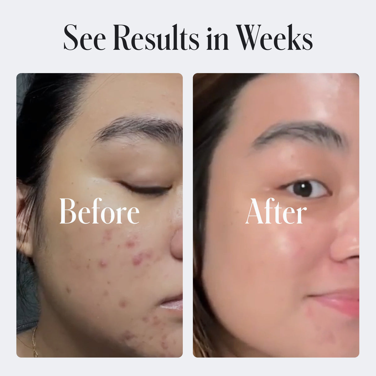 Acne Control Body Wash